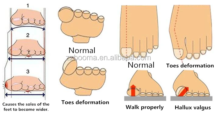 Gel silicone toe separator