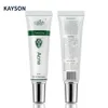 Korean Acne Away Moist Aloe Vera Face Anti Acne Whitening Best Pimples Removal Face Treatment Cream