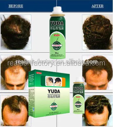 Herbal Extract Yuda Hair Loss Products/facial Hair Growth Cream ...