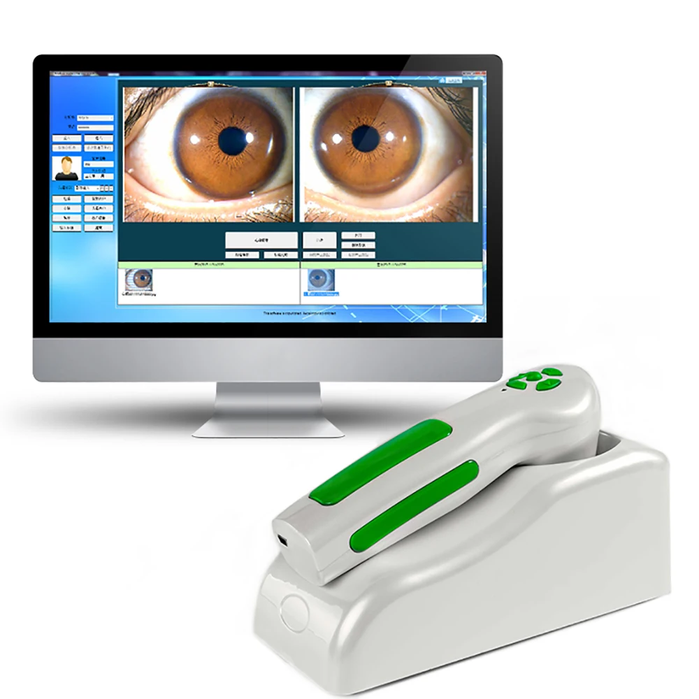 Multi-functions Eye Iriscope Iridology Camera Digital Test System Test ...