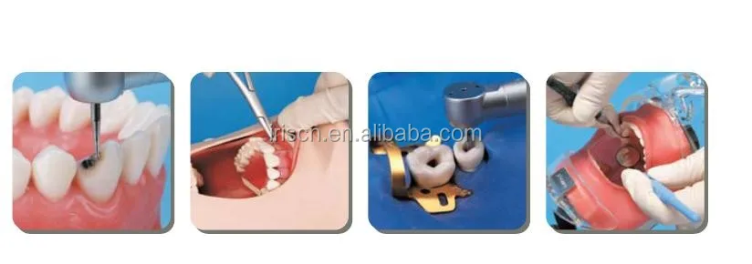 dental study models 1.jpg