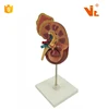 V-AM021 Life Lize PVC Plastic Medical Human Anatomy Kidney Model