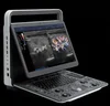 Sonoscape ultrasound scanner cardiac vascular color doppler Sonoscape E2 E3 ultrasound