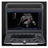 CE, FDA, ISO Approved convex probe pregnancy/baby use laptop human use ultrasound