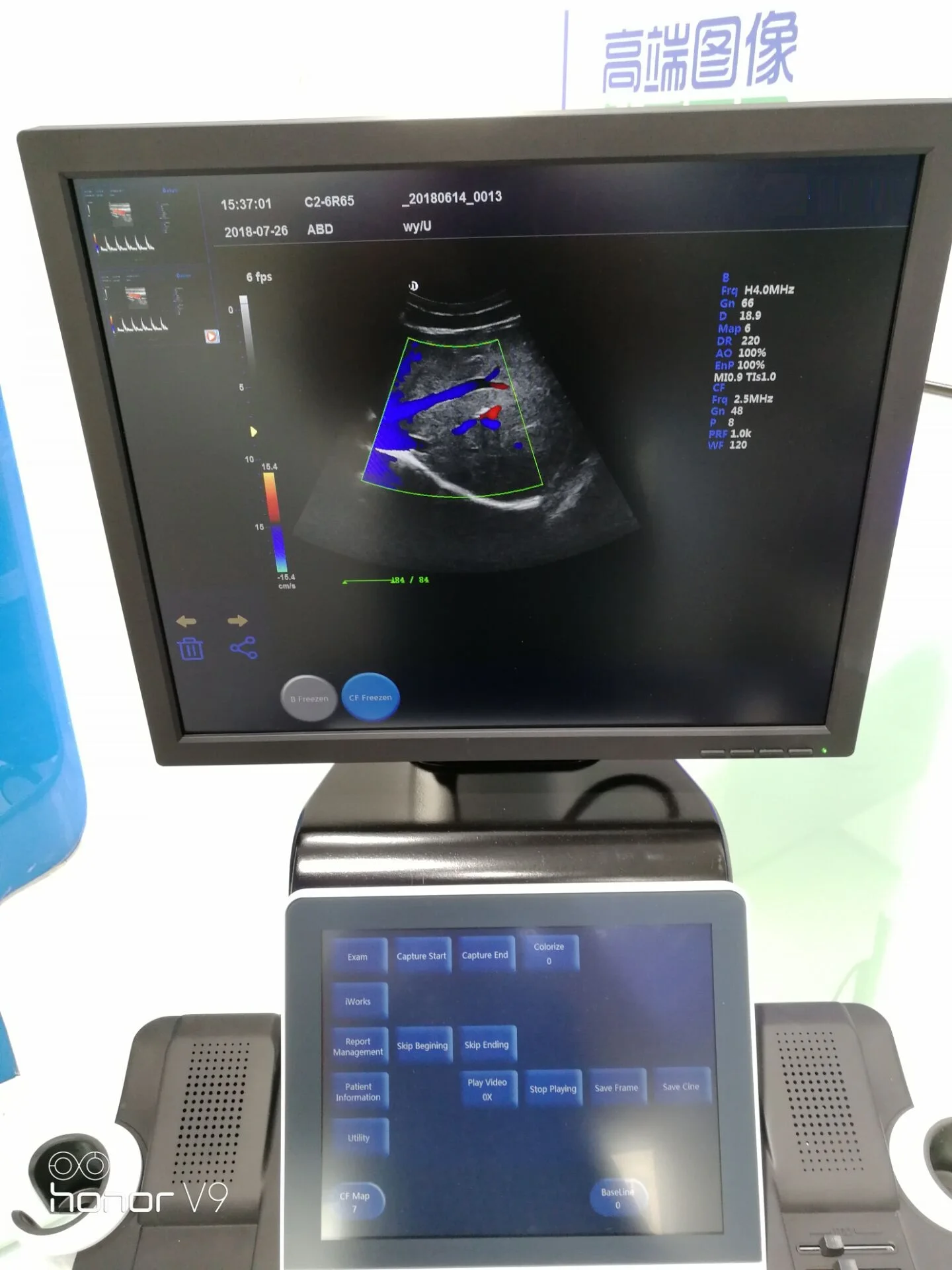 Cheap hospital best ultrasoundmachine 3d 4d ultrasound machine same as DC 8
