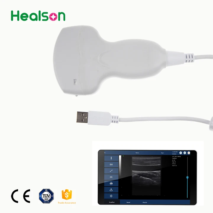 
Healson USB HS-UP20 Convex clinic smartphone/mobilephone ultrasound machine/system for abdomen/urology/OB/GYN 