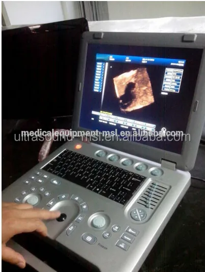 doppler ultrasound pregnancy cost