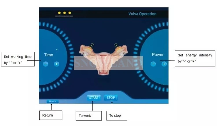 rf vaginal (15).jpg