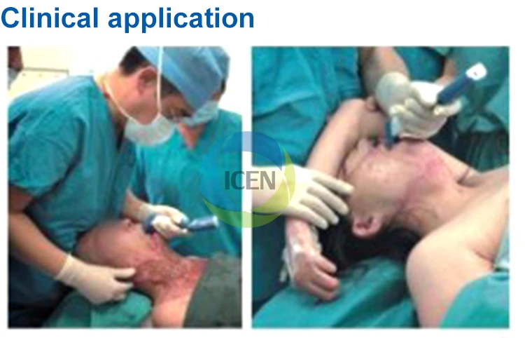 Video Laryngoscope