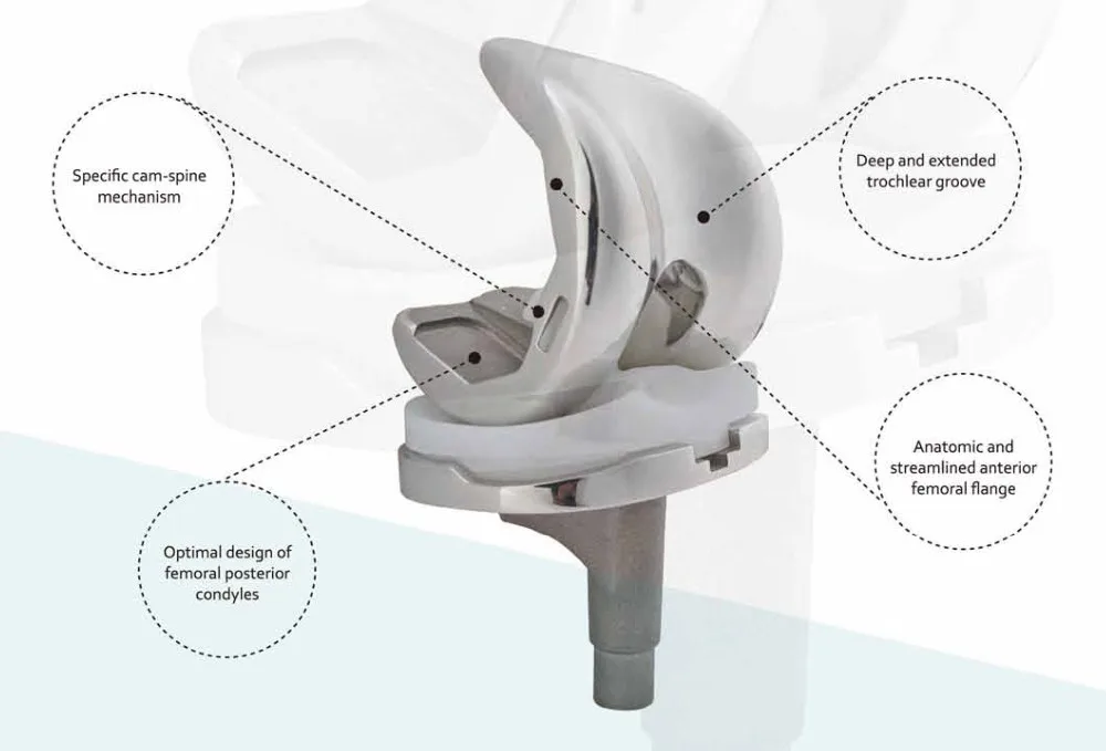 Factory Supply Titanium Knee Replacement Buy Knee Implants,Total Knee