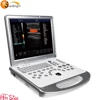 Dynamic Tissue Optimization 4D portable color doppler