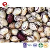 TTN black purple speckled and light speckled kidney bean