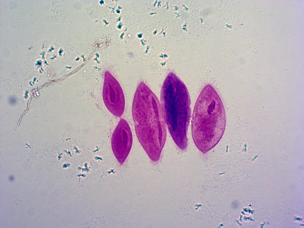 paramecium caudatum slide
