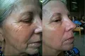 Argireline Serum Firming Face Lift Whitening Moisturizing Repair Anti Aging Skin Care Products 35ml