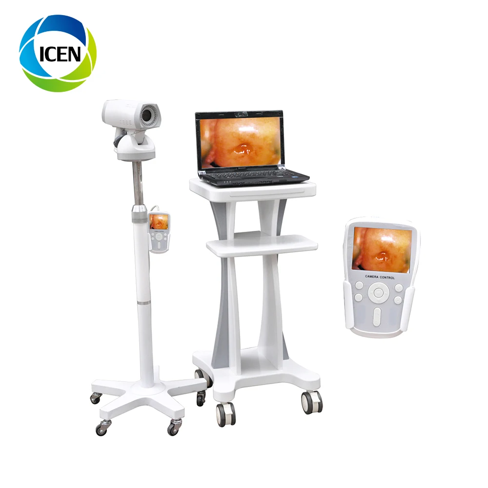 hd vagina colposcope