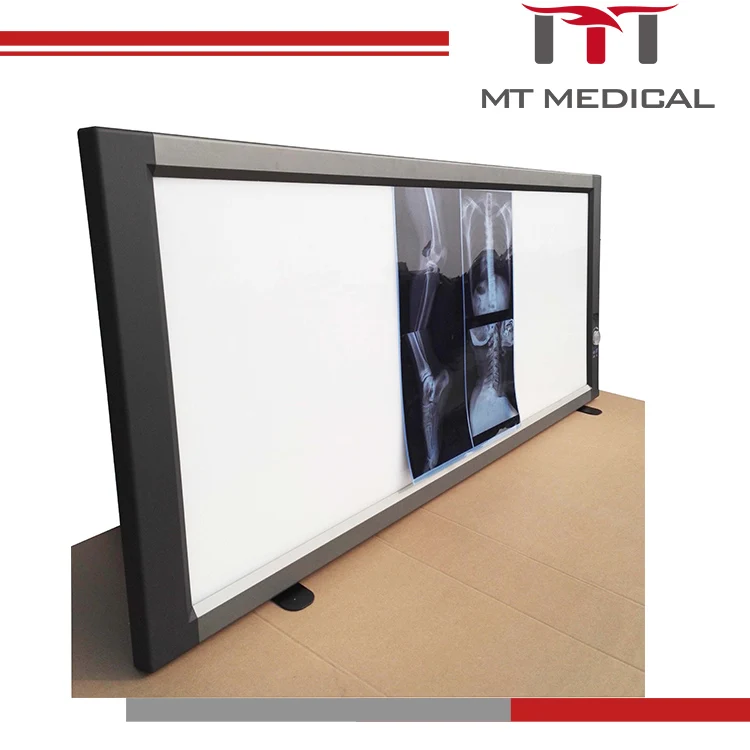 Hospital LED negatoscope triple x ray film view box 100ma x ray machine