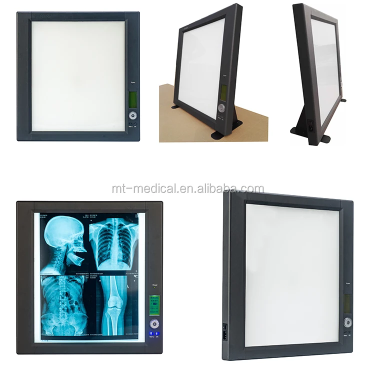 Medical LED X-ray Negatoscope X-ray Film Viewer Price for Sale