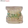 24pcs teeth orthodontic dental model with half metal & half ceramic bracket