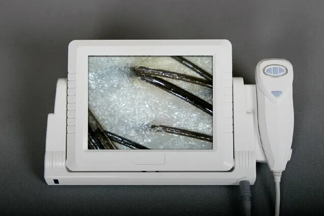 boxy skin and hair analyzer  AYJ-J019B (1).jpg