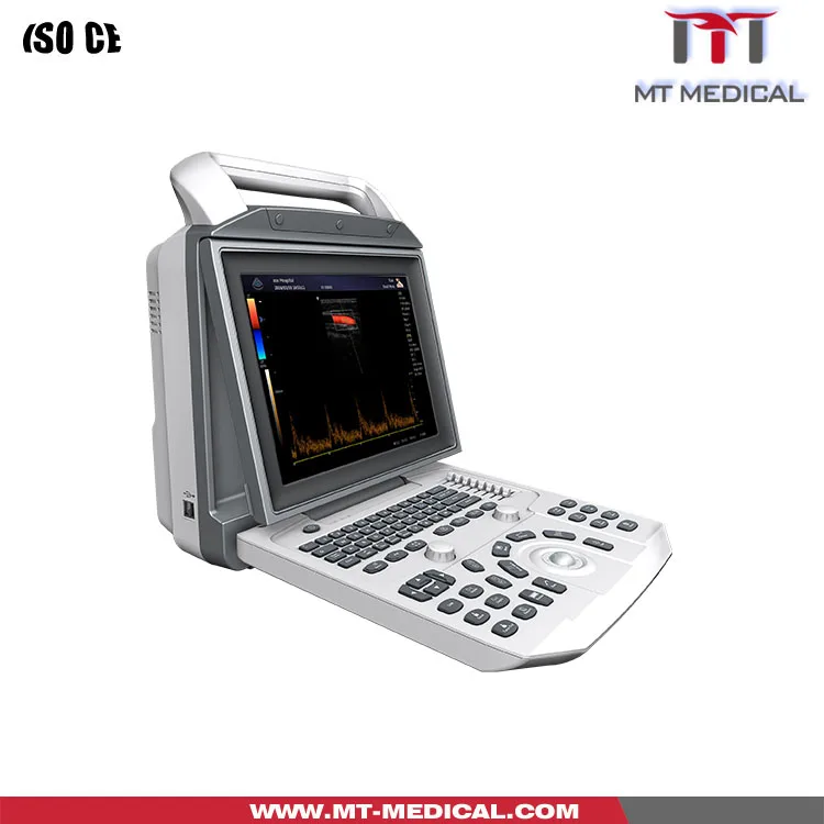 Ultrasonic USG ultrasound Scanner portable ultrasound usg