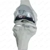 F-391 human knee implant model