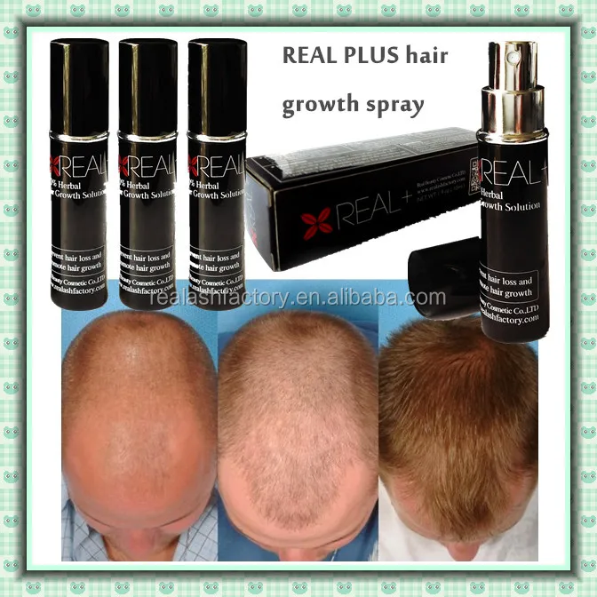 Which is an effective hair growth product for men with alopecia?