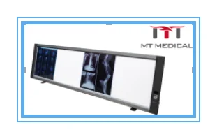Portable Medical Led X Ray Negatoscope Triple Machine