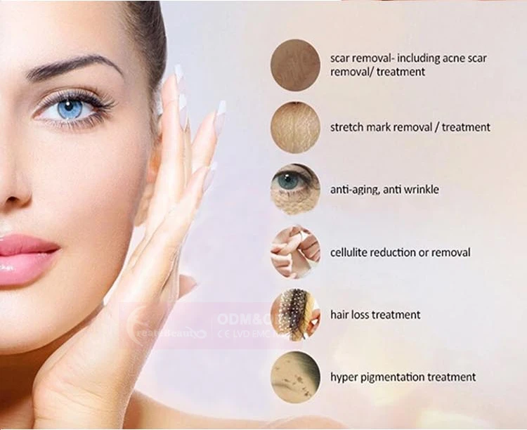 Factory sale meso pen ultima microneedling pen for personal use