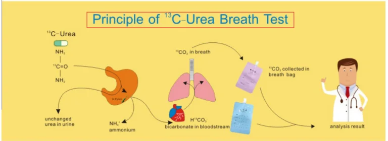test urea c13