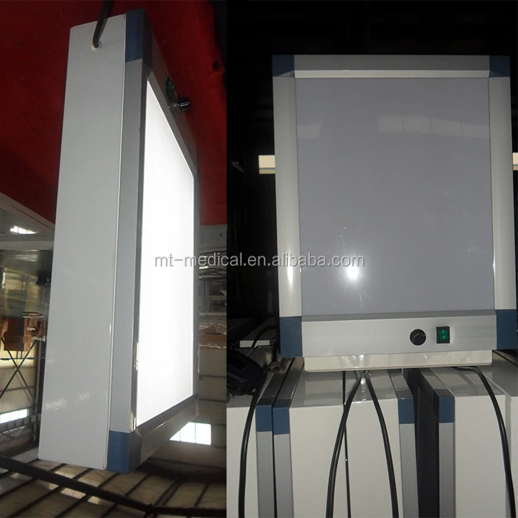 Negatoscope Double X-ray Film Viewer Price