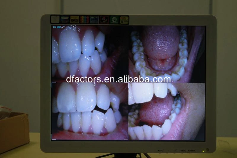 Led Monitor Intraoral Camera intra oral camera