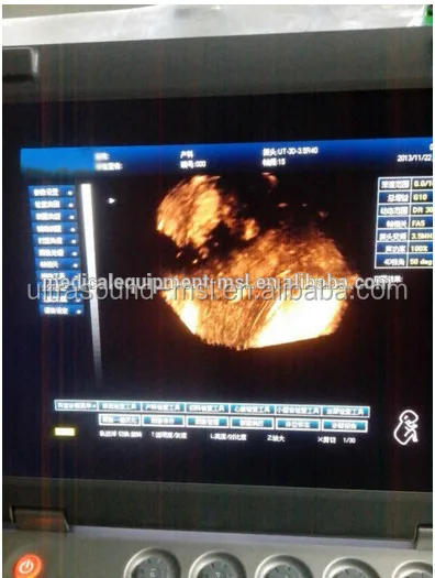 doppler ultrasound pregnancy at home