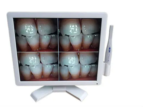 all in one intral camera_.jpg