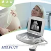 MSLPU28T New Cheapest Portable Ultrasound Machine Laptop Ultrasound Scanner Ultrasound Device for Sale