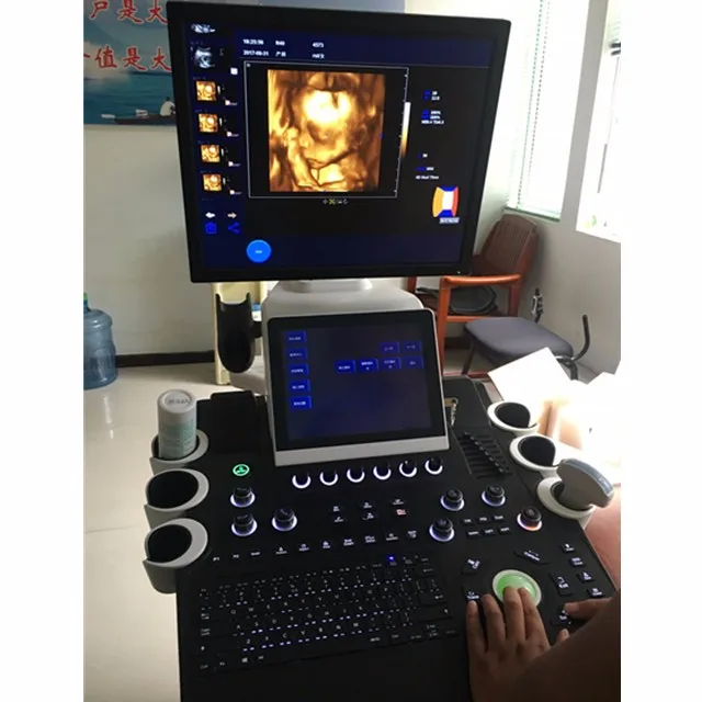 colour doppler ultrasound pregnancy in hindi factories