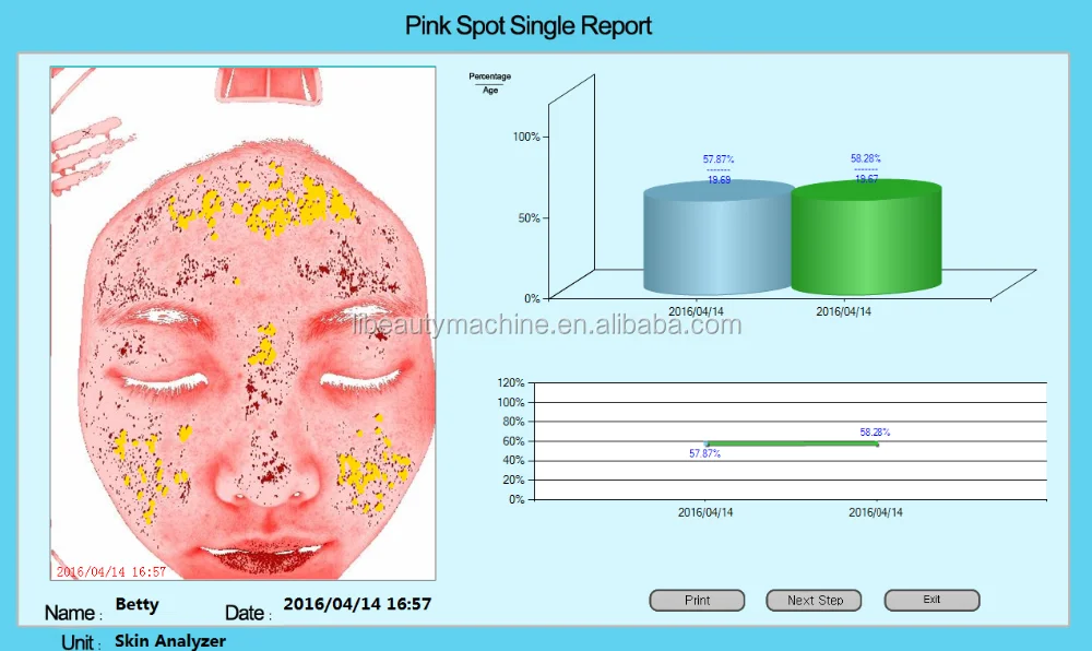 Magic Mirror Facial Skin Analyser Analyzer 4.png