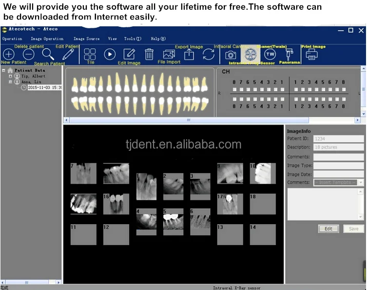 Ateco-Rvg-X-Ray-Digital-Dental-Intraoral-Imagining-System-Sensor-AT-301- (2).jpg