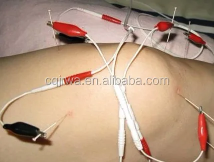 XXX Video - Electronic sperm collecting Canine anal gland melanoma