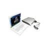 MSLPU15Z portable USB ultrasound convex linear probe/scanner price
