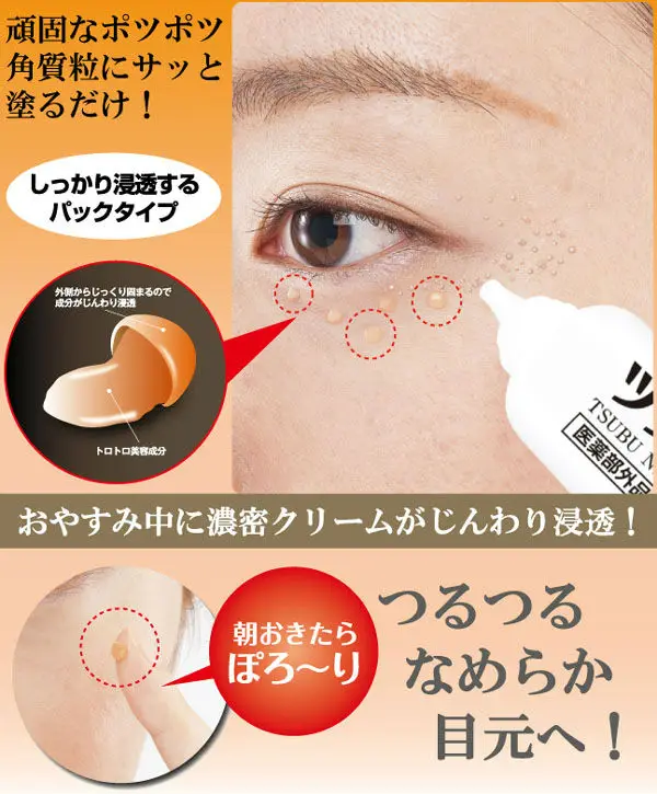 tsubunight-2
