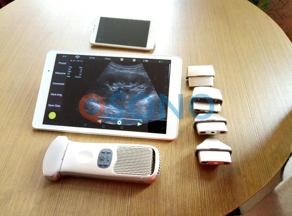 QSONO D8 pocket wireless Ultrasound probe / smart phone ultrasound