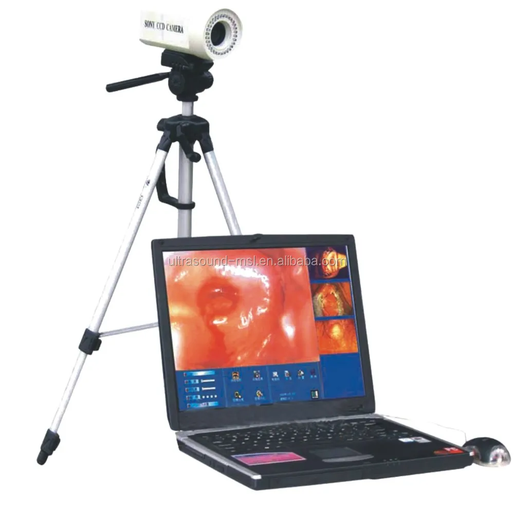 New Style Digital Video Colposcope/camera Colposcope/vaginal Colposcope ...