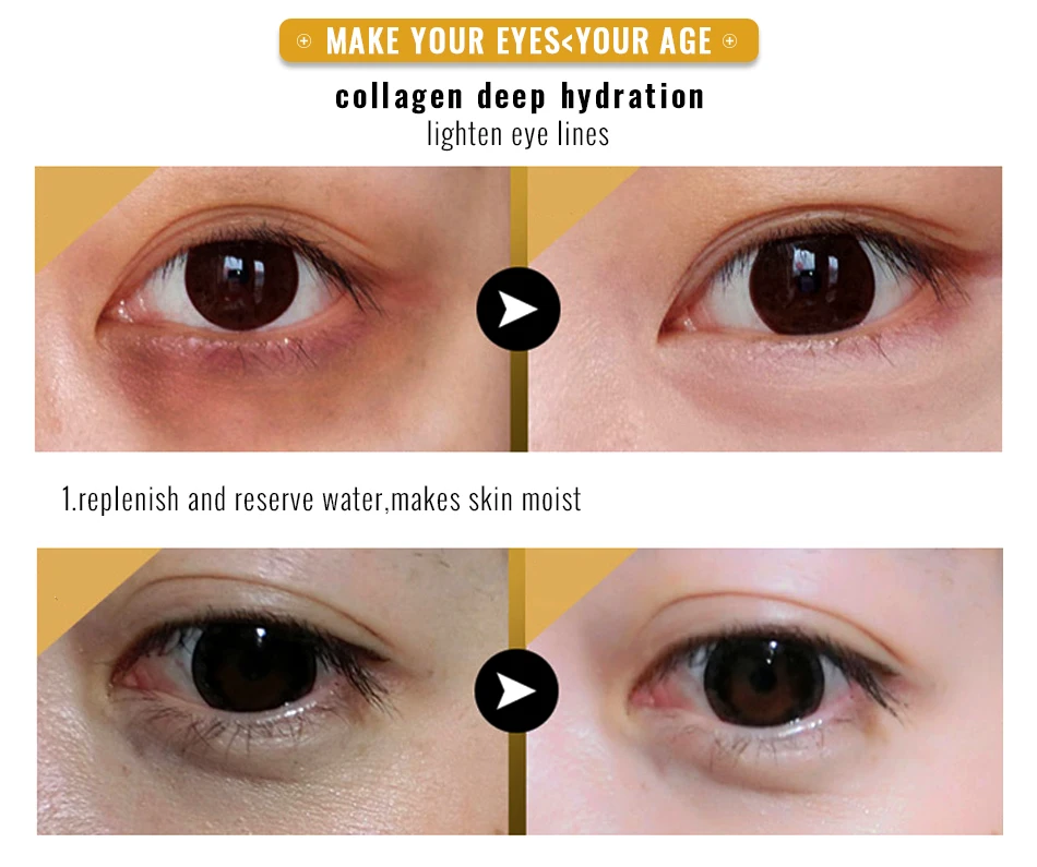 2 remove dark circles,eye bags relieve fatigue eys 3.