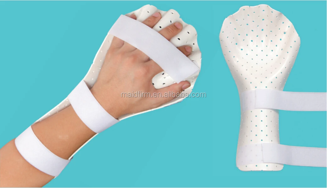 Thermoplastic Hand and Wrist Immobilization Splints for Orthopedic