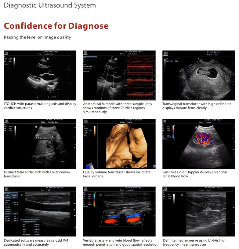 Doppler color Ultrasonido equipos Laptop/portable 3d ultrasound scanner portable color doppler ultrasound