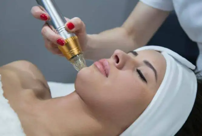 美容个人护理 2019 分数 rf 和微针 rf 美容机