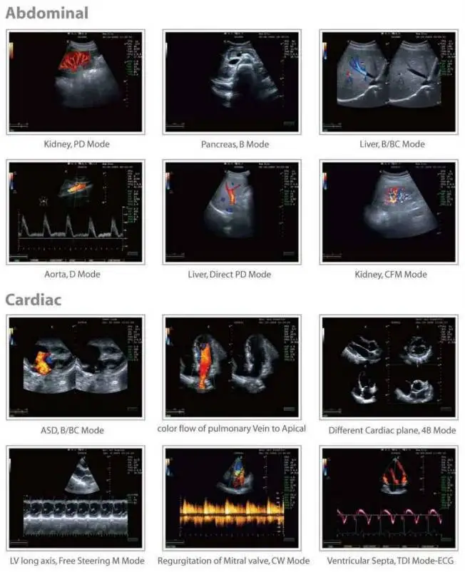 Besten Wert 3d Tragbare Farb Doppler Ultraschall Fetal Doppler