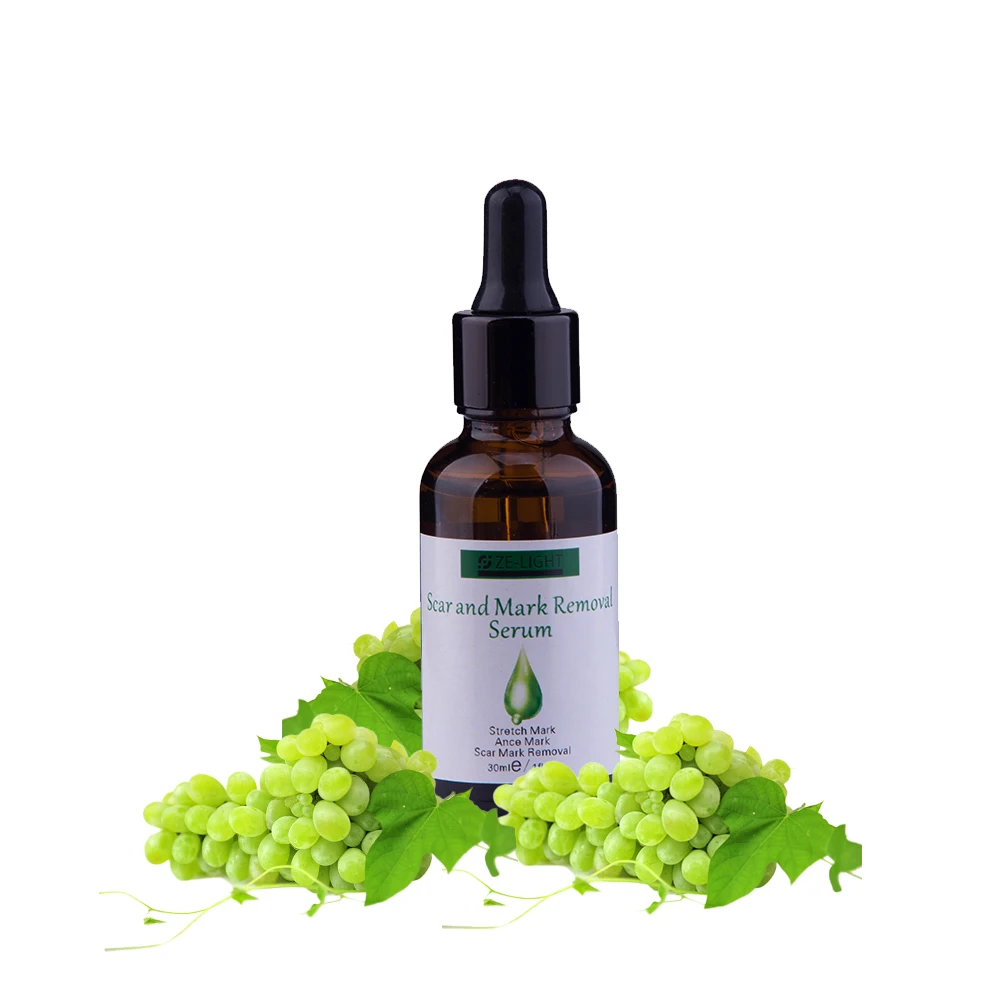 lotion to remove dark spots