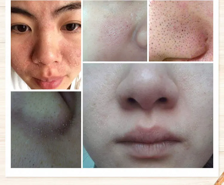 Images moisturizing nourishing korean Natural Essence honey mask for face care