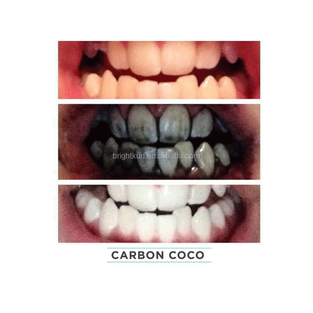 Отбеливание зубов углем. Органический уголь для зубов. Отбеливание зубов углем до и после.